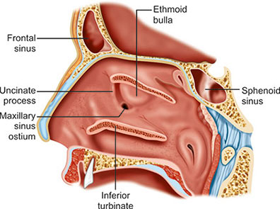 <p>Ethmoidal bulla in middle meatus</p>