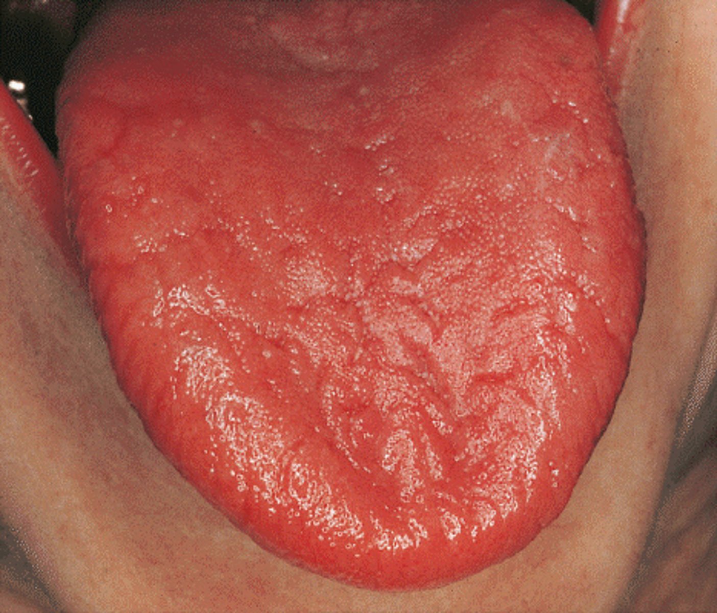 <p>B.cytokine.</p>