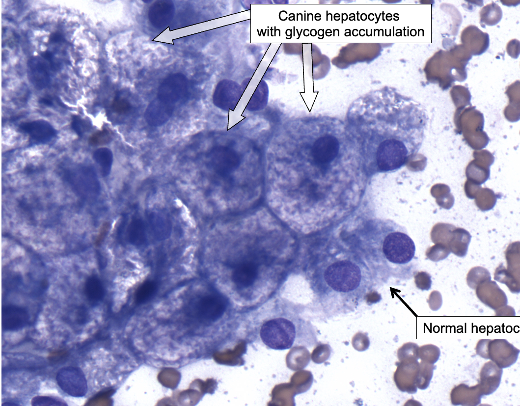 <ul><li><p><span>Increased glycogen deposition can cause swelling of hepatocytes, visible with light microscopy as diffuse vacuolar change.</span></p><ul><li><p><span>“Hydropic change” can have a similar appearance</span></p></li></ul></li><li><p><span>This can occur with glucocorticoid treatment (e.g., prednisone) or hyperadrenocorticism in dogs, which stimulates gluconeogenesis (leading to increased glycogen synthesis).</span></p><ul><li><p><span>Glucocorticoids in general have an “anti-insulin” effect.</span></p></li></ul></li></ul><p></p>