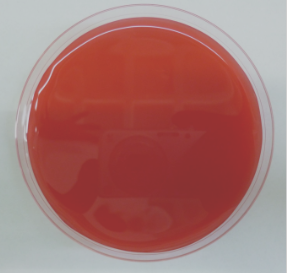 <p></p><p>Identifica el siguiente medio (rojo opaco) de cultivo y su aplicación</p>