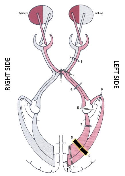 <p>what is it? what does it result in?</p>
