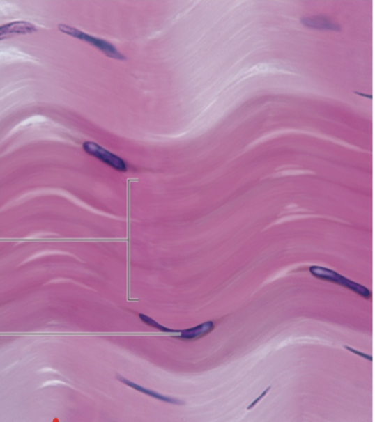 <p>Connective Tissue: What tissue is this and the function?</p>