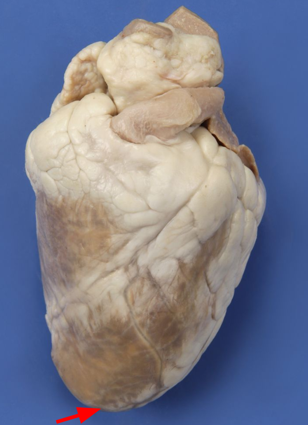 <p>What area is pointed out?</p>