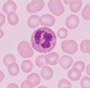 <p>it has distinct nuclei with many lobes</p>