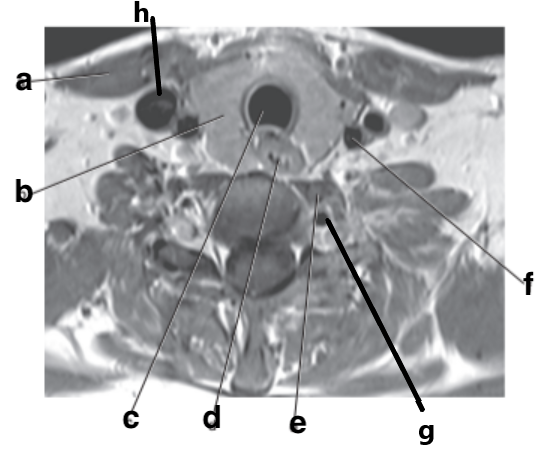 <p>What is letter d?</p>
