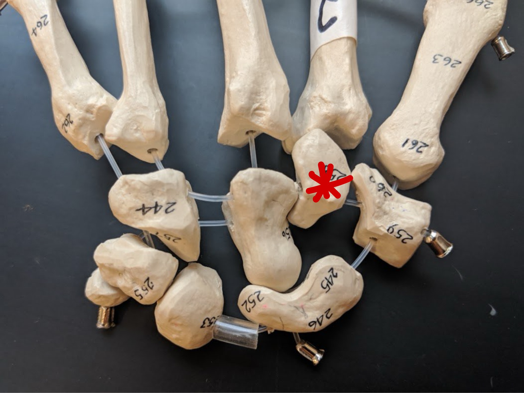 <p>Name this bone</p>