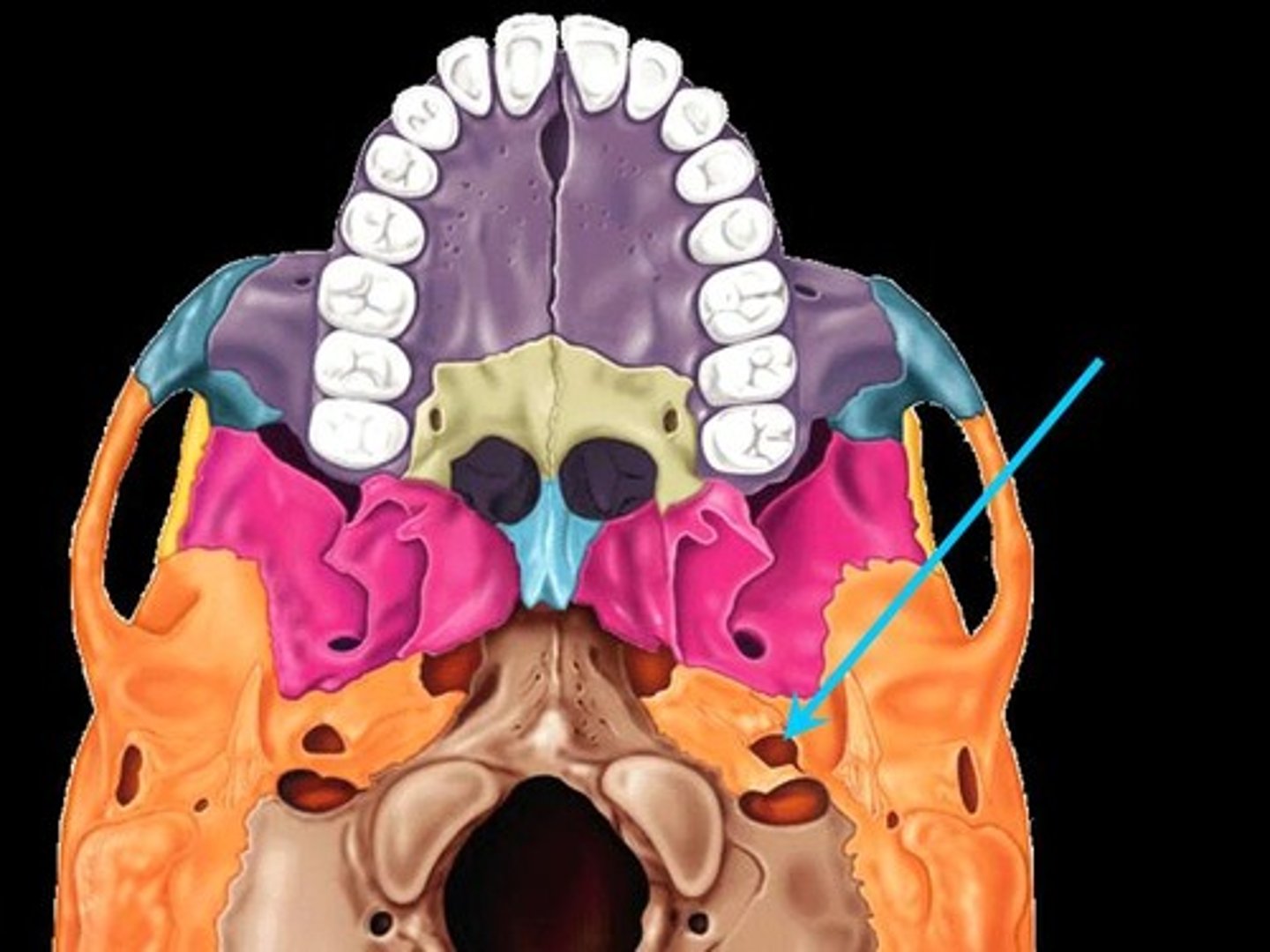 <p>(<strong>Inferior aspect of the skull, mandible removed)</strong></p>