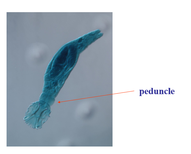 <p>what does the peduncle do?</p>