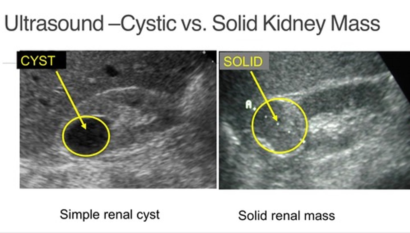 <p>Cysts: hypoechoic &amp; fluid-filled</p><p>Mass: hyperechoic &amp; solid</p>
