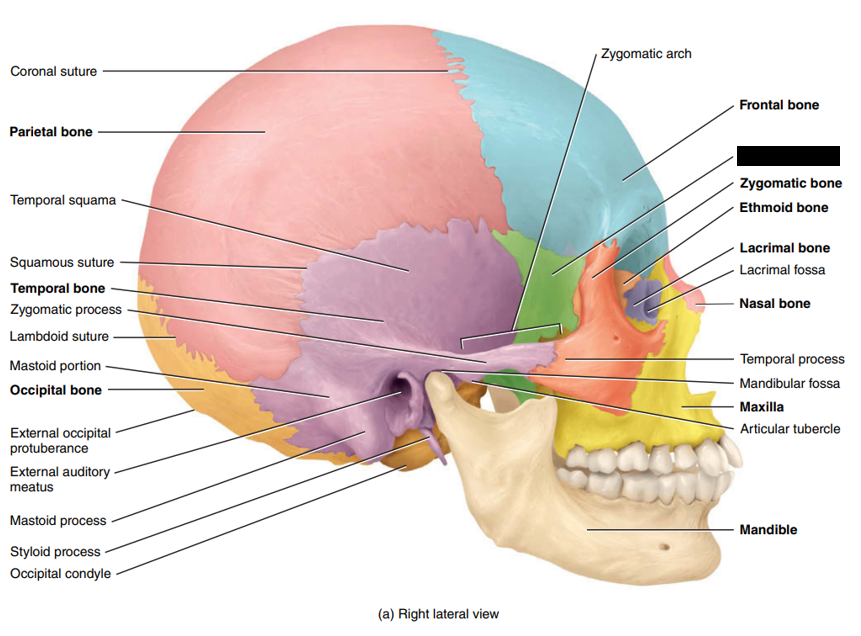<p>State and identify what part of the cranial bone is being pointed out and censored. (hint: bone)</p>