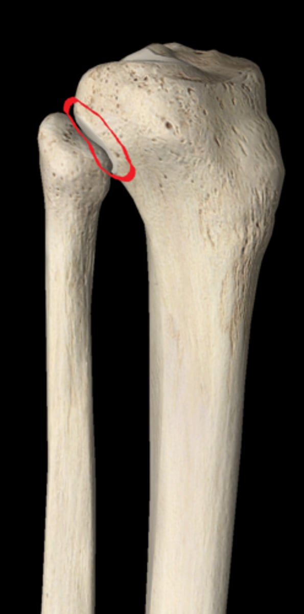 <p>flat circular articular facet on the inferior and lateral aspect of the lateral condyle of the tibia for articulation with the head of the fibula</p>