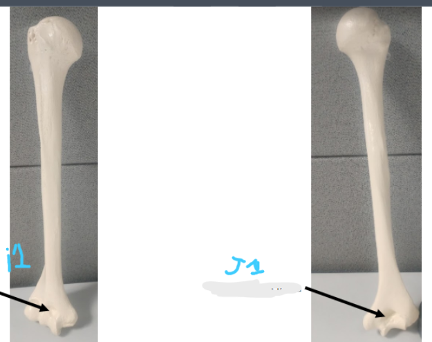 <p>What is J1? </p>