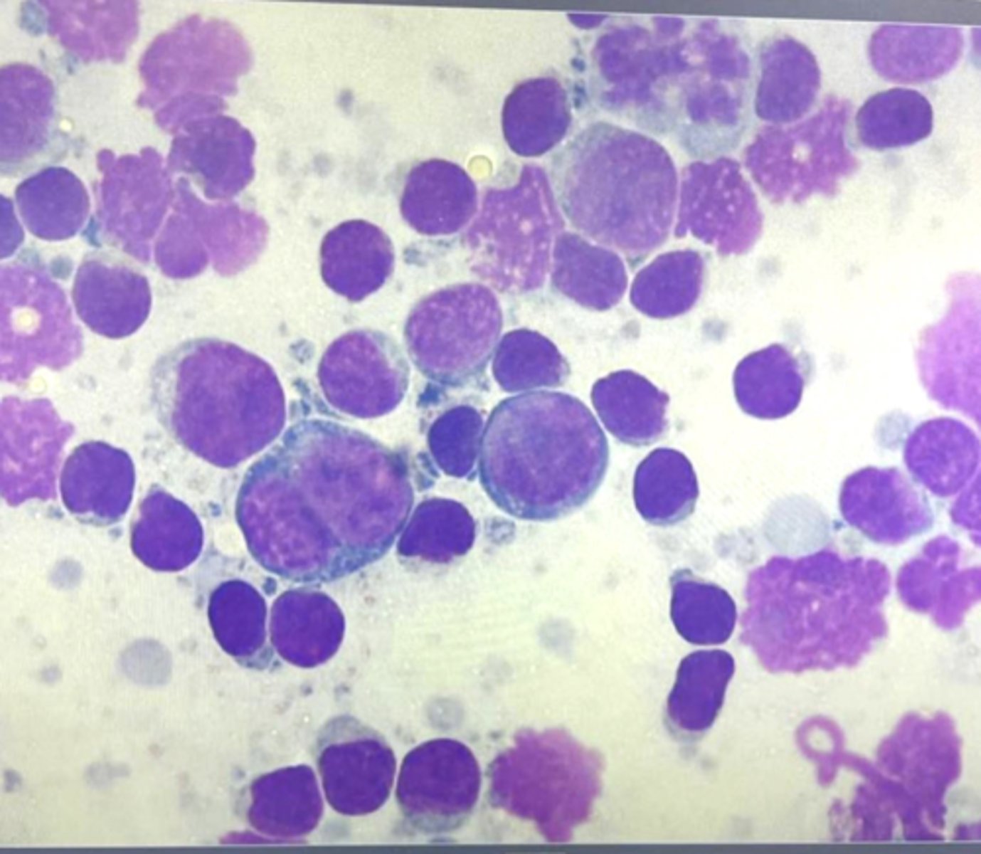 <p>What type of round cell tumor is this?</p>