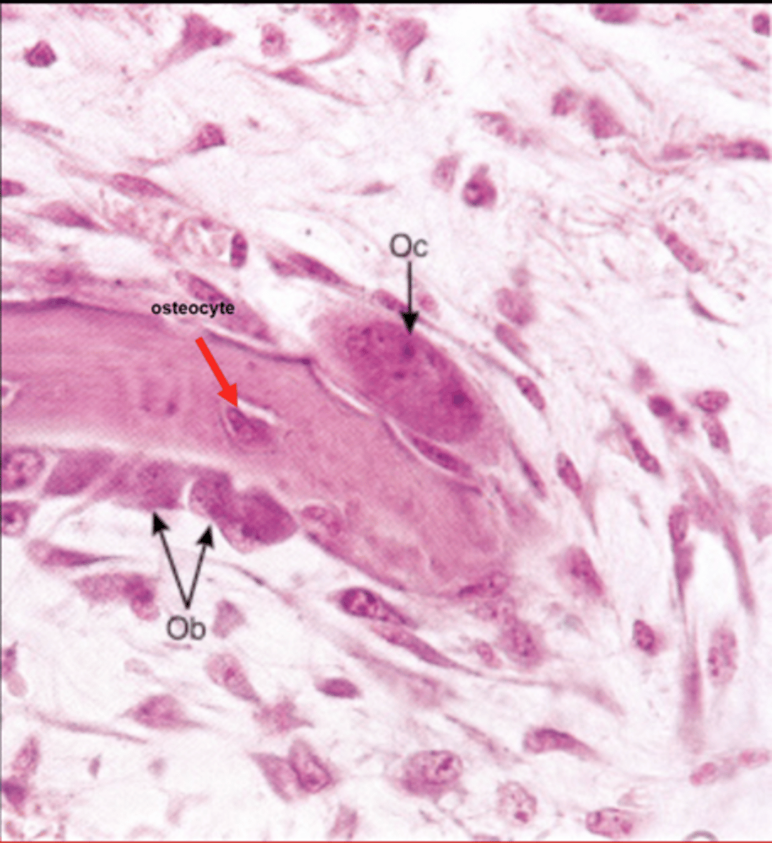 <p>osteocyte it resides in the lacuna</p>