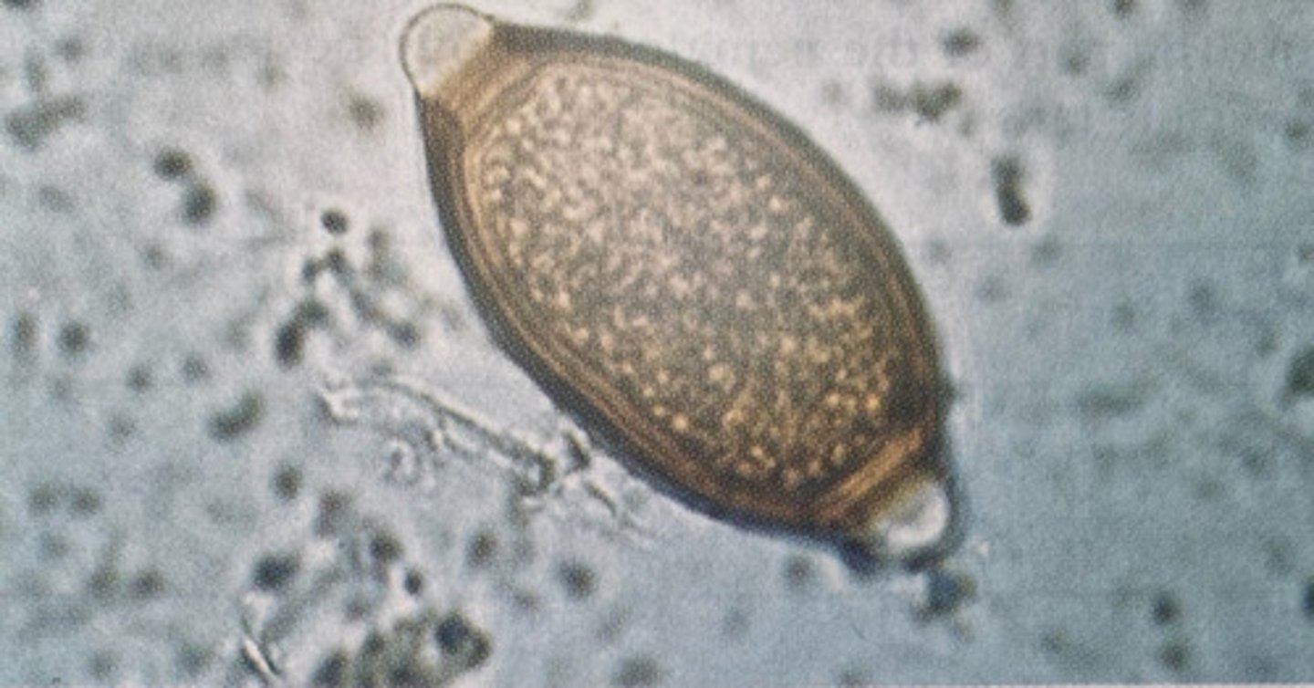 <p>What kind of egg is this</p>