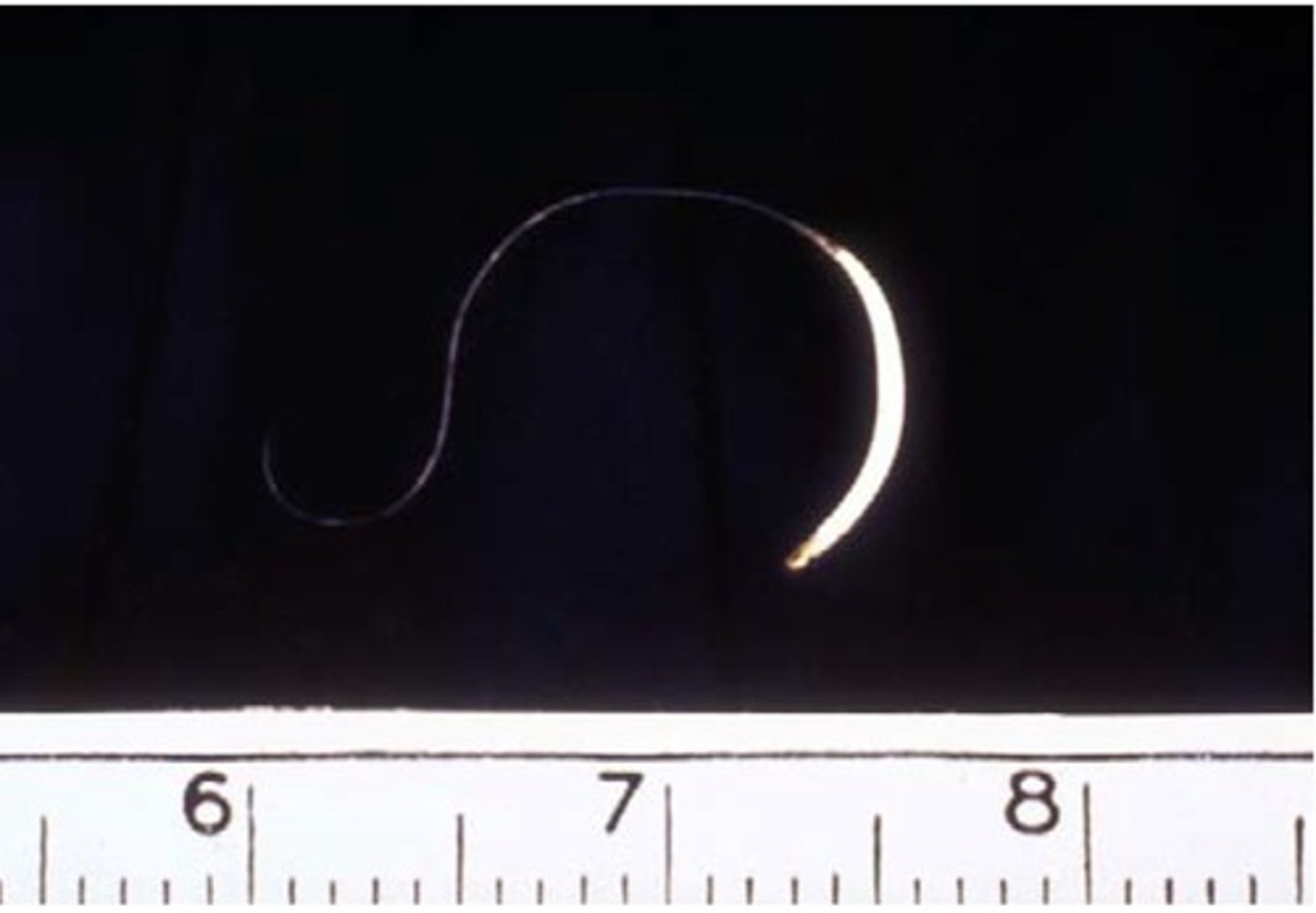 <p>d. Trichuris trichiura</p>