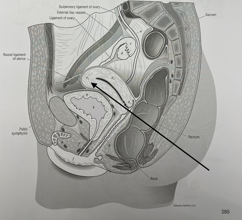 <p>what structure is this</p>