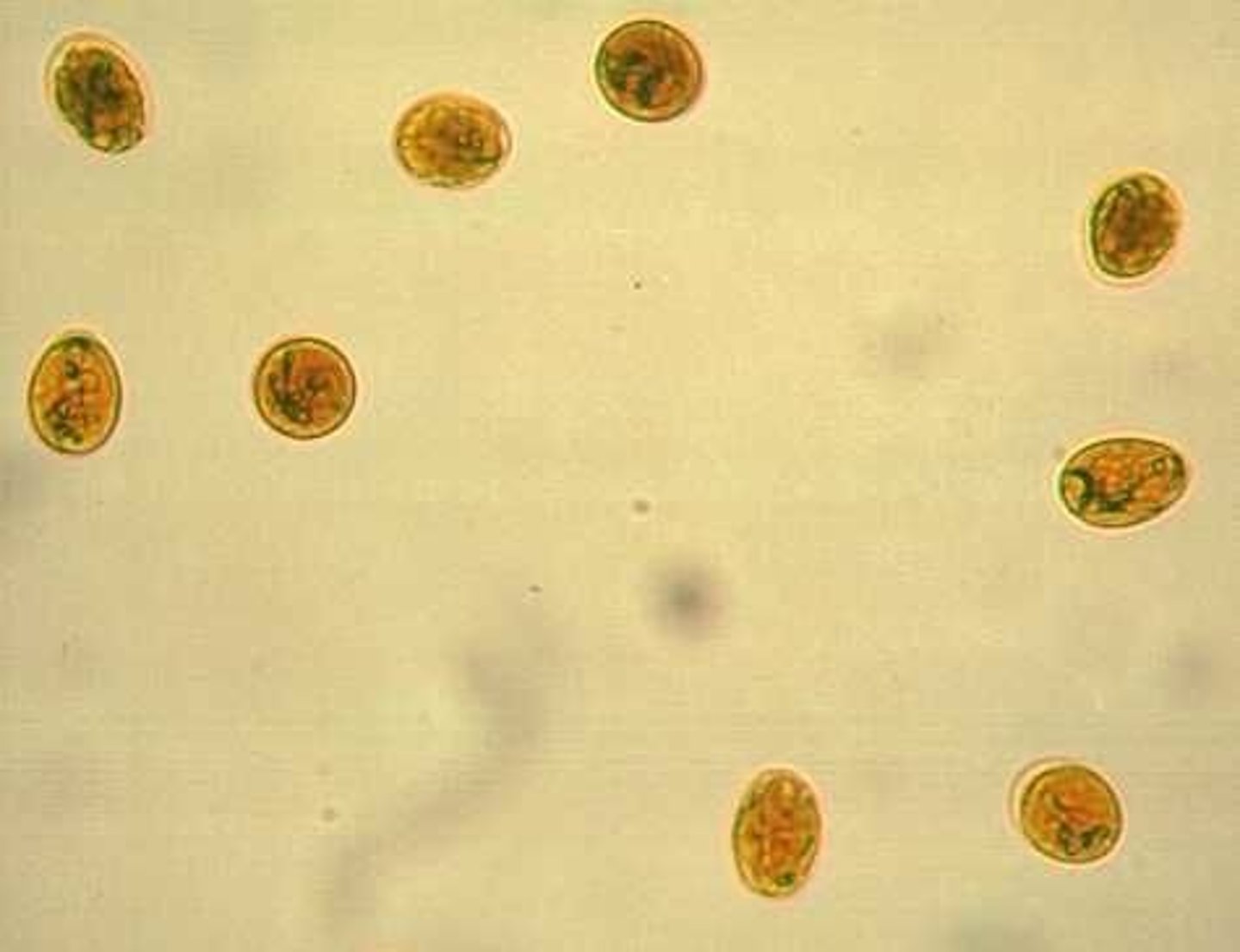 <p>the cysts are shed in the feces. Giardia is contracted through ingestion of contaaminated water or feces. Giardia can often be asymptomatic, but it can cause vomiting, foul-smelling diarrhea, and loss of appetite. It is diagnosed via direct smear or SNAP test. the prepatent period for a cyst is 5 days. Giardia is one of the smallest intestinal parasites and should be seen using a 40x objective lense. Throphozoites are ususally only seen whhen the patient is experiencing runny stool because they do not have traction to stay within the GI system.</p>