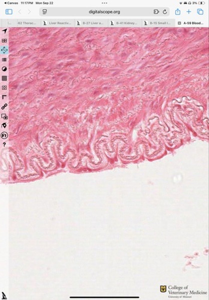 <p>What tissue type is shown?</p>