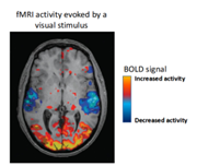 <p>Magnetic pulses pick up evidence of demand for more oxygen in the brain, creasting a blood oxygen level-dependent (BOLD) signal</p>