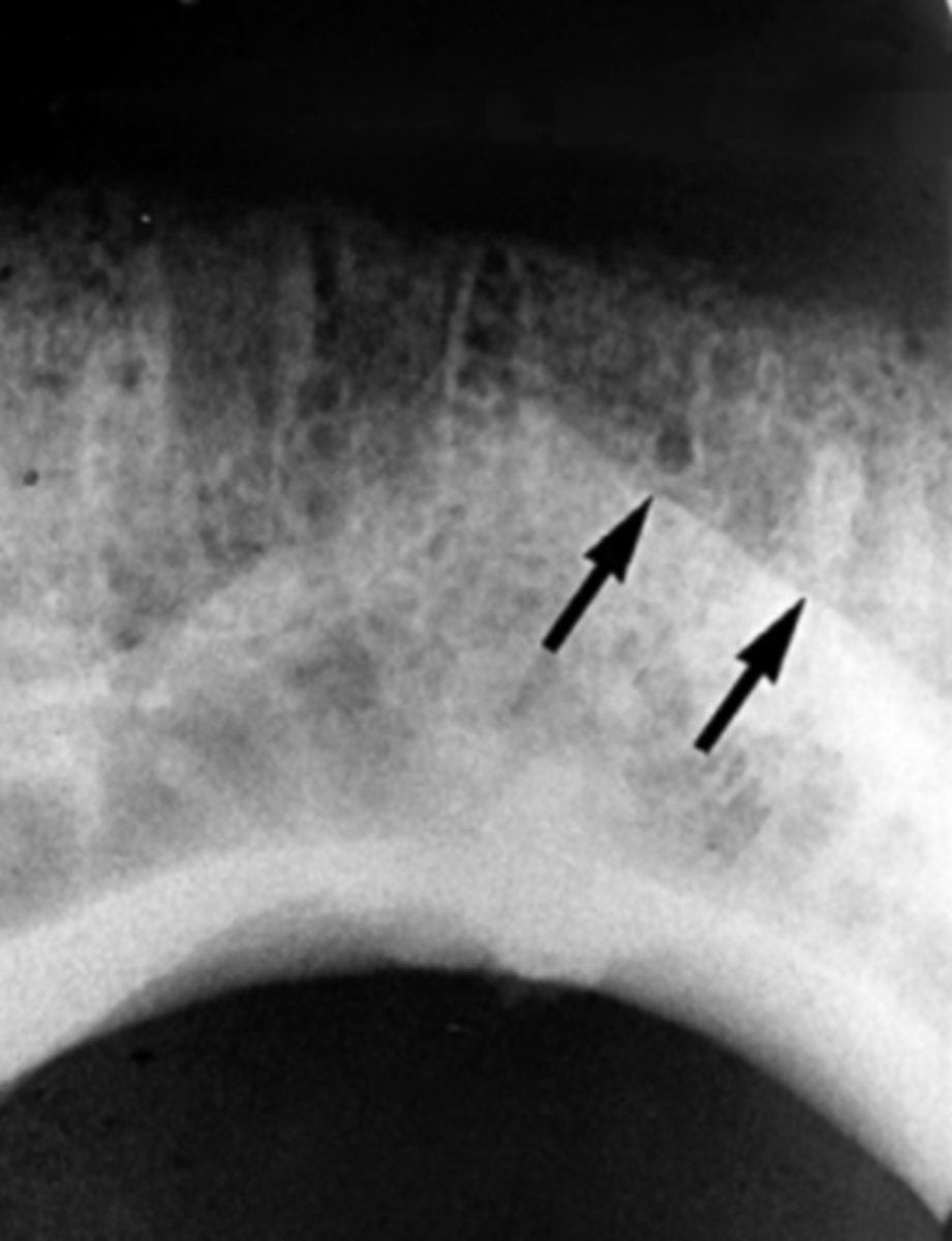 <p>Identify the radiopaque structure</p>