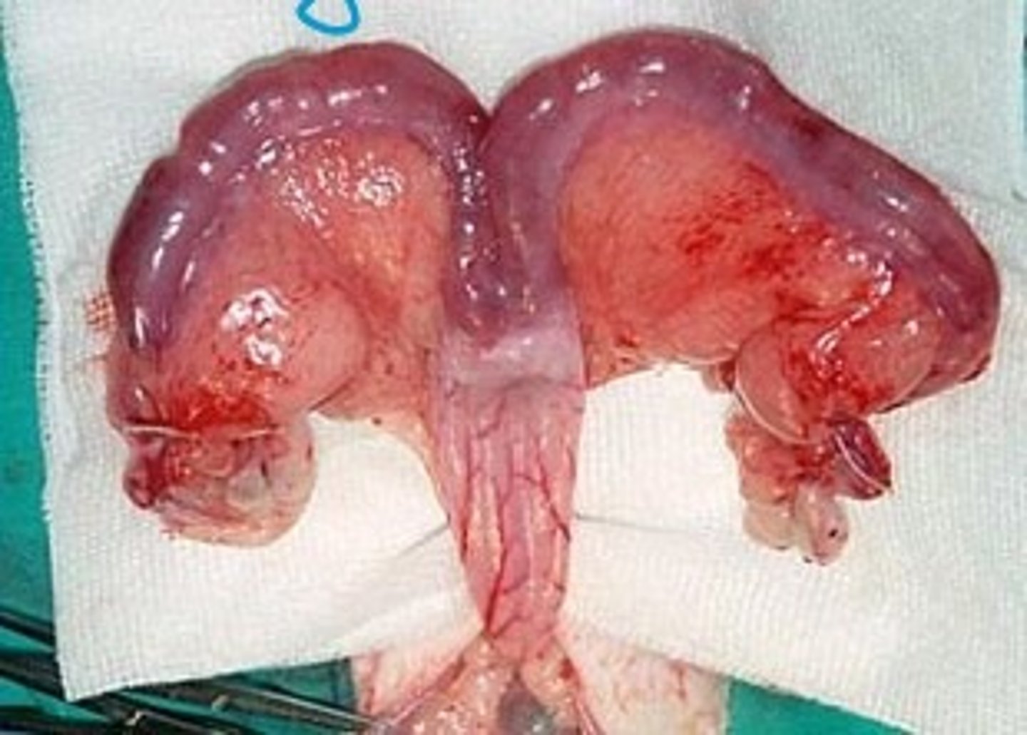 <p>What type of uterus is a doe's uterus?</p>