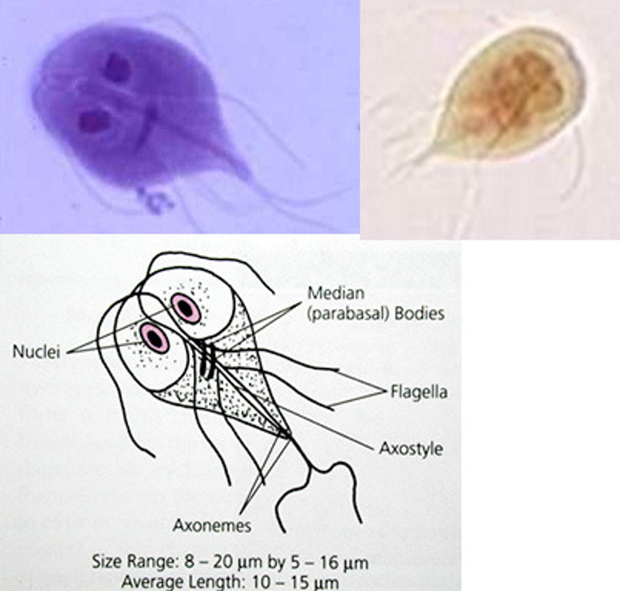 <ul><li><p>host(s), zoonotic? site in host,</p><ul><li><p>Zoonotic, multiple species serve as host, asexual reproduction, gastrointestinal tract (Small Intestine)</p></li></ul></li><li><p>disease caused, sources of pathogenicity</p><ul><li><p>Giardiasis, Direct contact/ Toxic substance produced by parasite (antigenic)/ Loss of absorptive surface</p></li></ul></li><li><p>diagnosis (life stage and type of sample), symptoms, treatment, transmission.</p><ul><li><p>Cysts in stool, Fat in stool/ Explosive Diarrhea/ Dehydration/weight loss/ intestinal discomfort, Antibiotics</p></li><li><p>Transmission = 6 Fs (Fingers, food, feces, flies, fluids, fomites (object capable of carrying infection))</p></li></ul></li></ul><p></p>