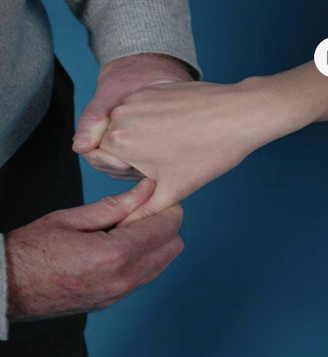 <p>- identify degenerative joint disease in the metacarpophalangeal or metacarpotrapezial joint</p><p>- The examiner holds the patient's hand with one hand and grasps the patient's thumb below the metacarpophalangeal joint with the other hand. The examiner then applies axial compression and rotation to the metacarpophalangeal</p><p>joint</p><p>(+): If pain is elicited, the test is positive and indicative of degenerative joint disease in the metacarpophalangeal or metacarpotrapezial joint</p>