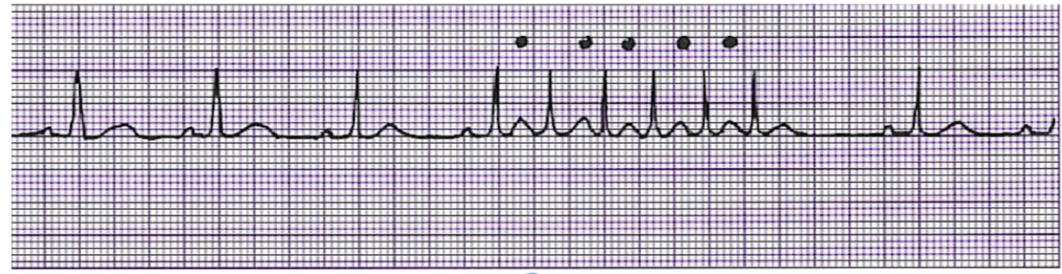 <p>What is this rhythm?</p>