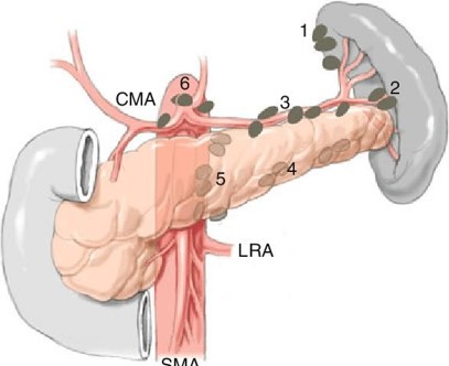 <p>To the <strong>pancreatico-splenic</strong> lymph nodes</p><p></p><p>N.B : Red bulb of the spleen has no lymphatic</p>