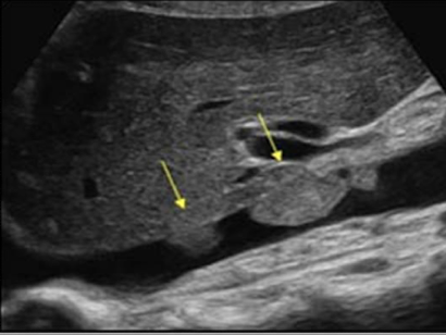 <p>does not have blood flow</p>