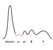 decreased alpha 1; emphysema, lung and liver disease