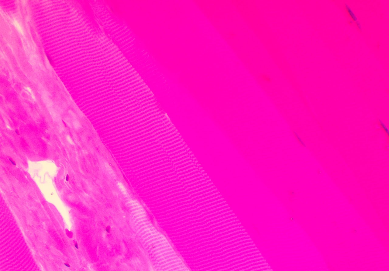 <p><span>Skeletal muscle is voluntary and found in all the muscles that help move the skeleton</span></p>