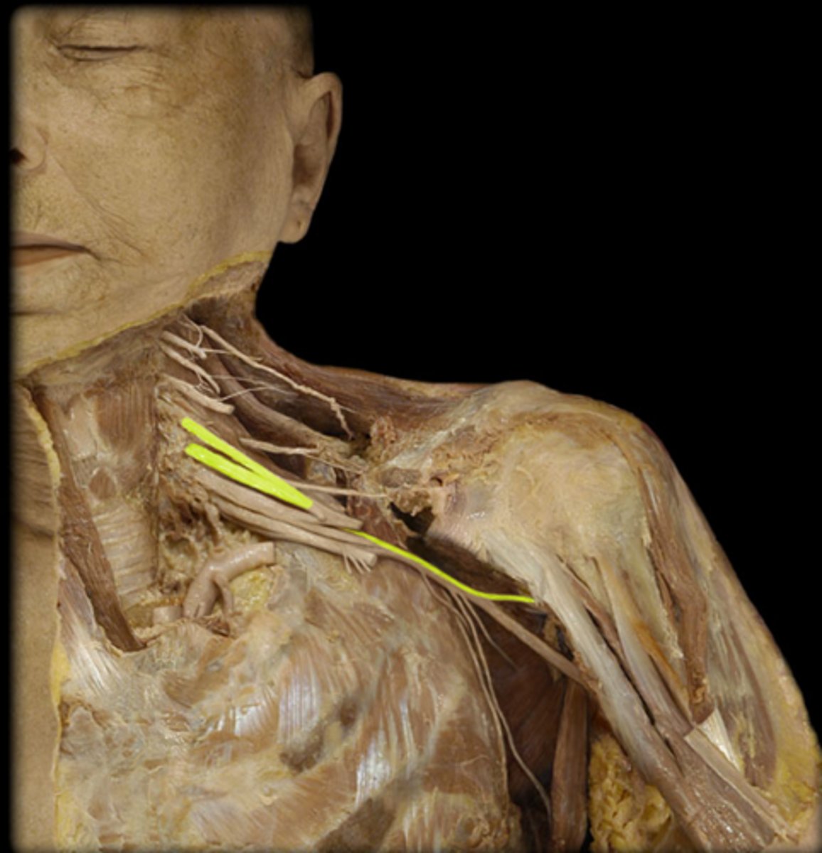 <p>Deltoid &amp; teres minor</p>