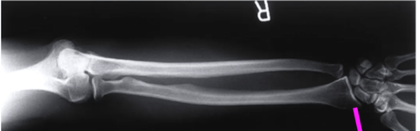 <p>what does this pink line point to?</p>