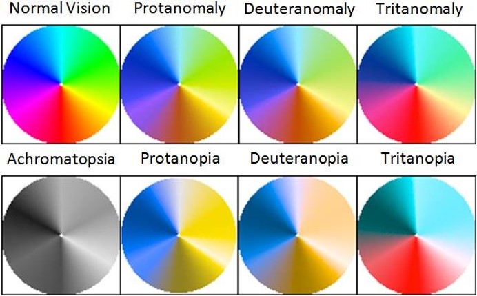 * Prevalent in 5-8% of males and 0.5% of females
* X-chromosome recombination causes colour vision defects
  * S gene on chromosome 7
  * M and L gene on X
* Colour deficiency (mild) - trichromats
* Colour blindness (severe deficiency) - dichromats and truly colour blind
  * More men affected than women because X chromosome defects are frequent and men only have an X chromosome
* See diagram for different variations (Melillo et al., 2017)