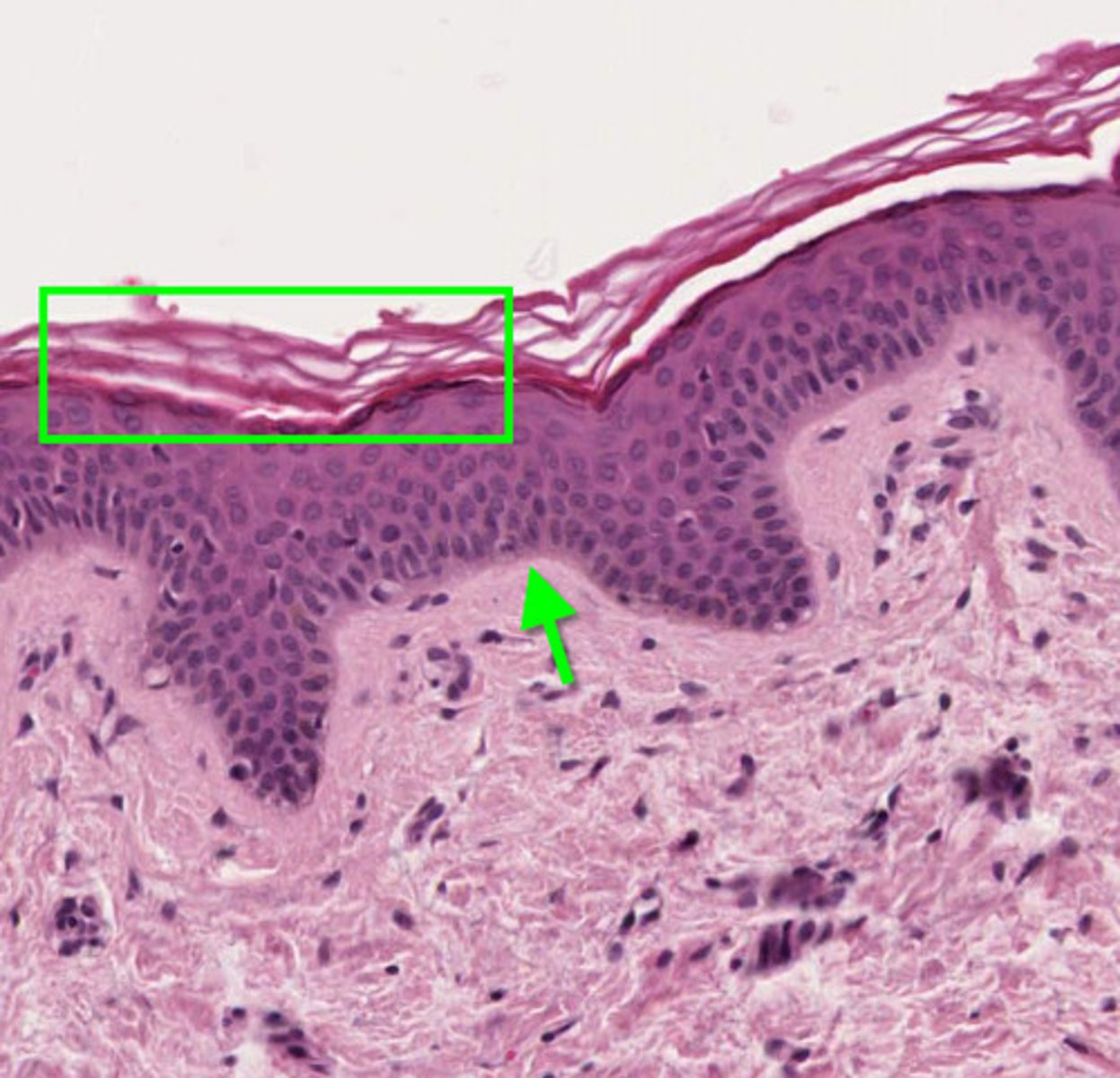 <p>Epithelium with flat cells in layers of dead cells, found in the epidermis, palms, and soles for abrasion resistance.</p>