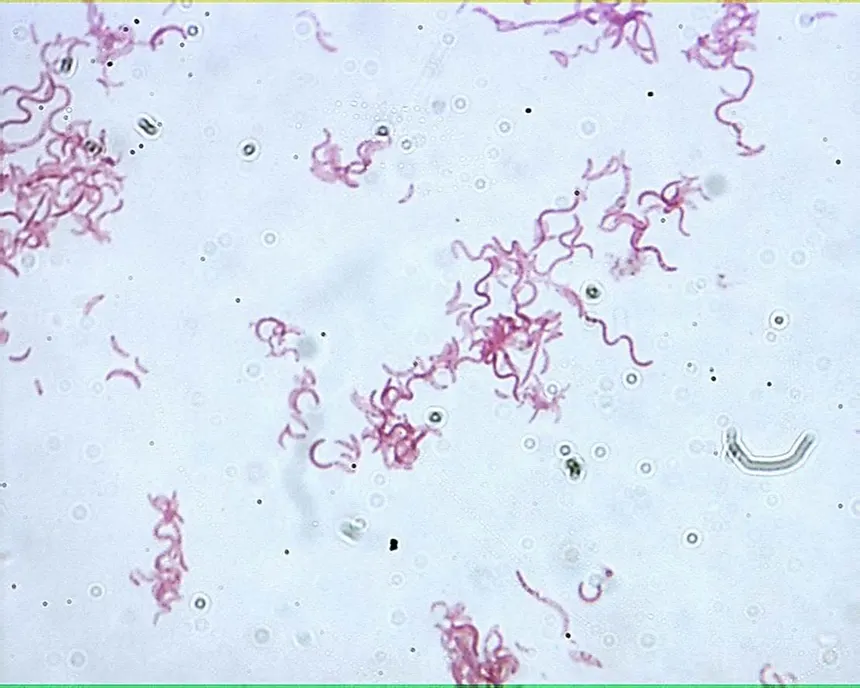 <p>(5) What shape is this bacteria?</p>