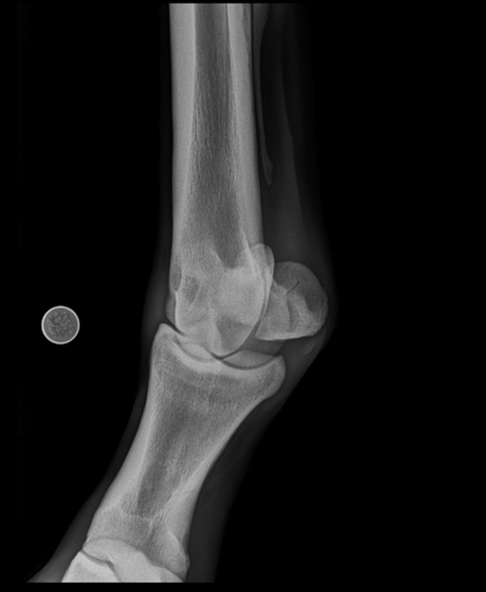 <p>Name the view and the anatomical region within the radiograph</p>