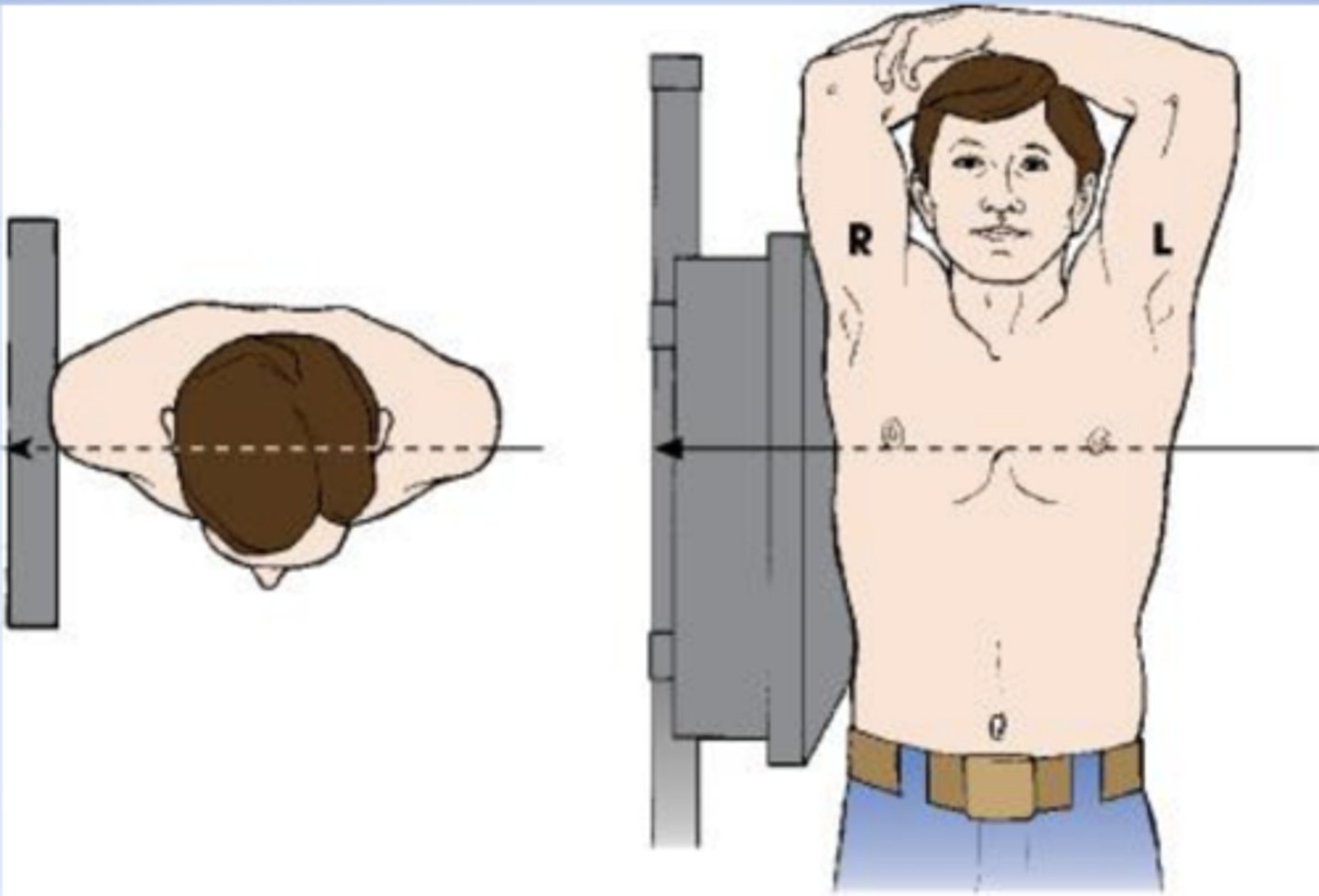 <p>radiographic position of the chest results in a lateral projection:</p><p>a lateral position is named according to the side of the patient that is placed closer to the IR</p>