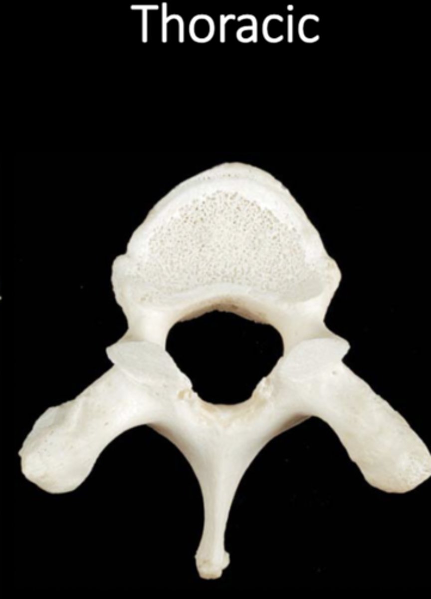 <p>"giraffe"</p>