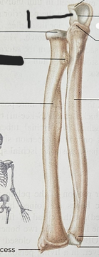 <p>What is structure #1?</p>