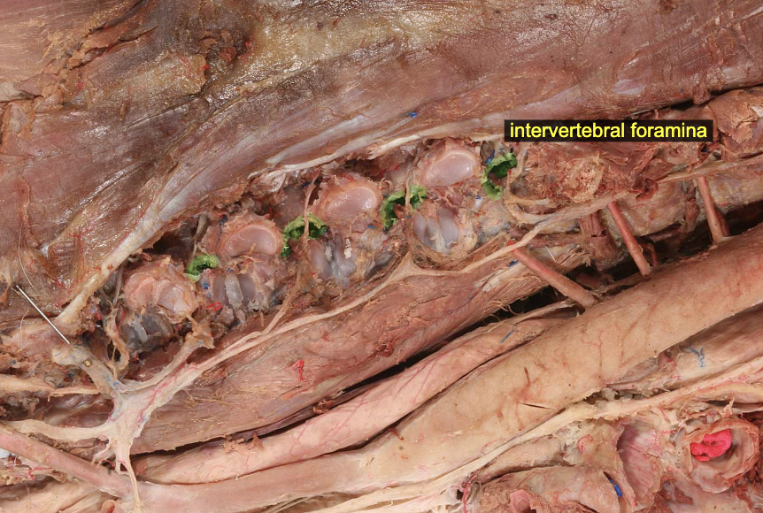 <p>formed by cranial &amp; caudal vertebral notches of neighboring vertebrae</p>