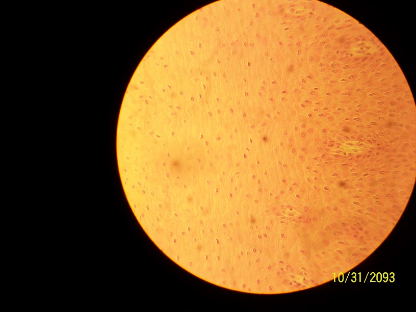 <p>Stratified Epithelium</p>