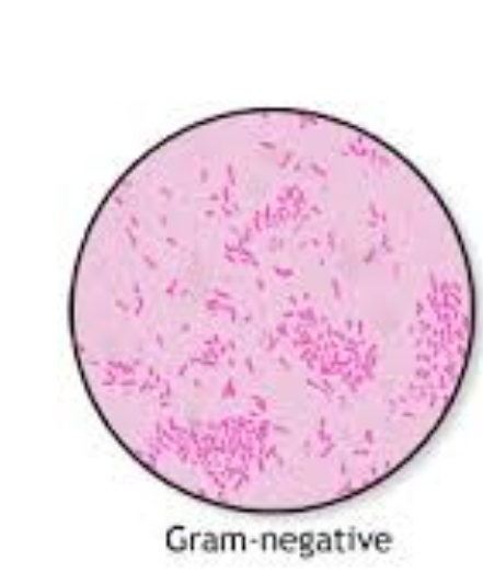 <p>gram negatives appear red/pink</p>