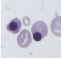 <p>What is the name of the nucleated cell?</p>