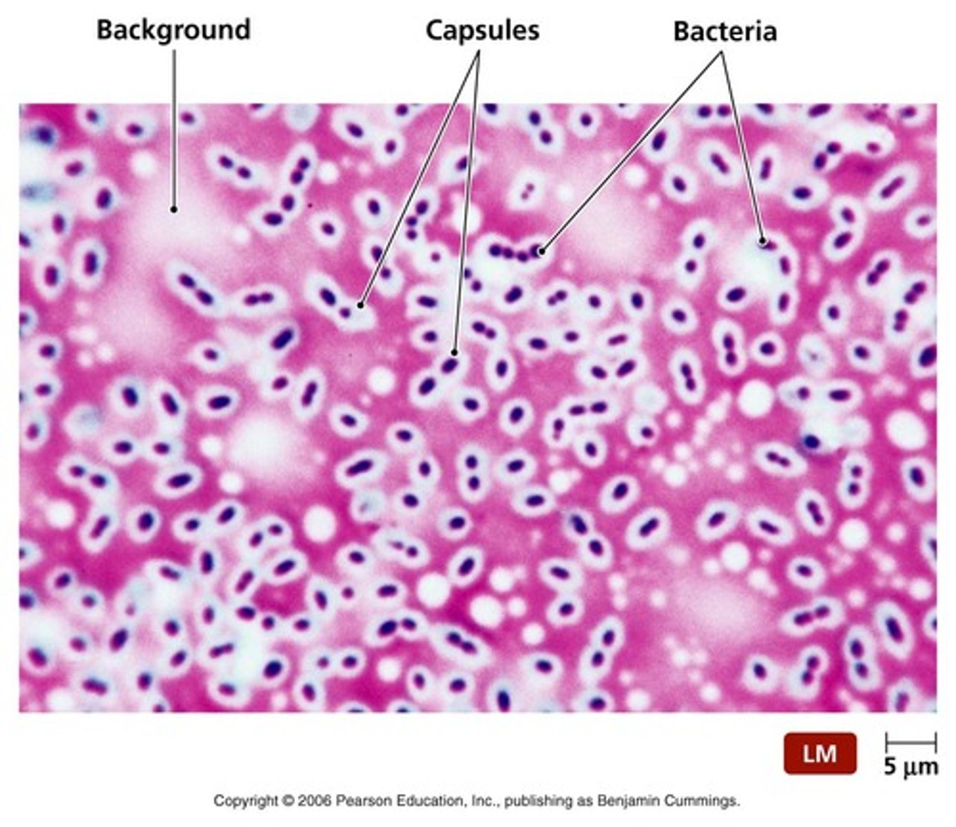 <p>Step 1: india ink repels capsule</p><p>Step 2: Crystal violet counterstains the cell inside the capsule</p>