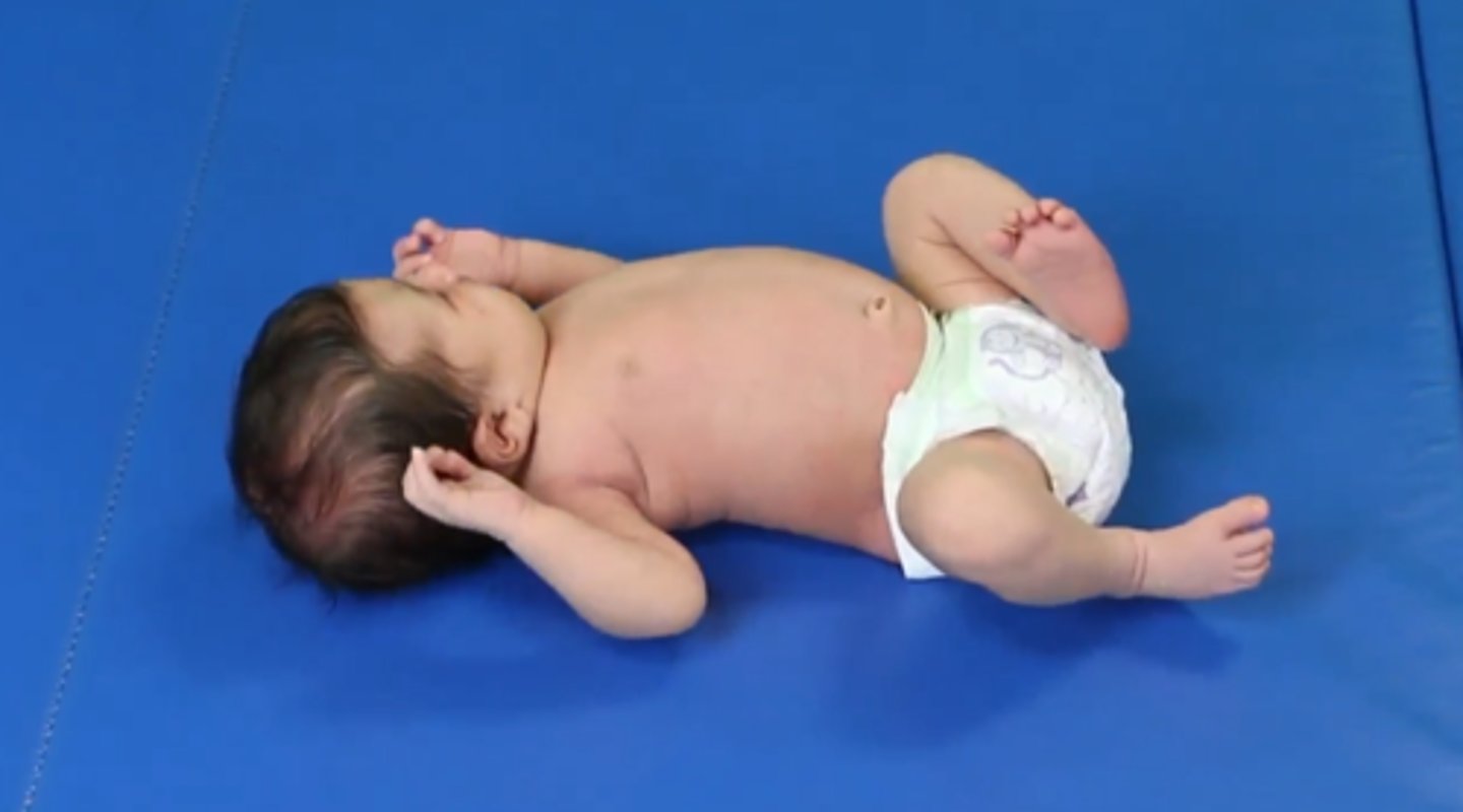<p>1. Random arm and leg movements</p><p>2. Limbs are flexed and don't extend completely</p><p>3. Head is kept ONE side (neck muscles aren't strong enough to hold head in midline yet)</p>