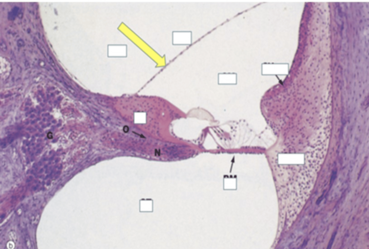 <p>Identify the structure</p>