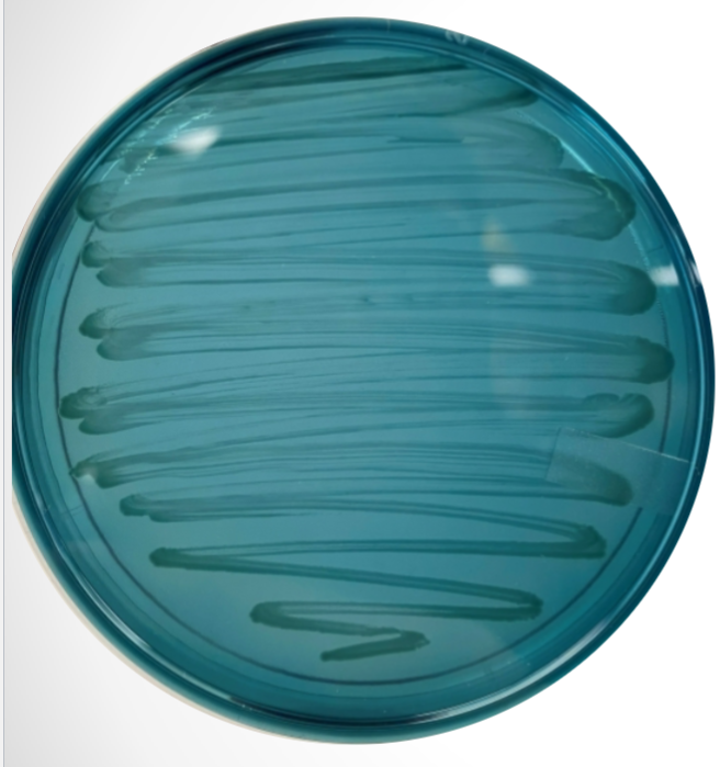 <p>What agar is used in this test? What bacteria was used and what does the reaction suggest?</p>